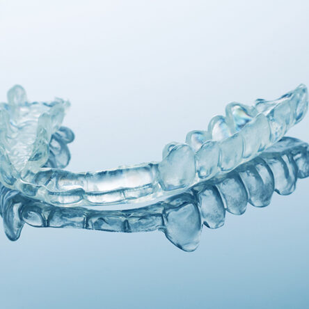 Affordable Invisalign Options at iSmile Dental – Dr. James Helmy, Boca Raton