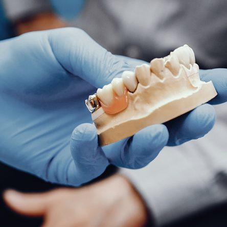 dental bridges boca raton, restorative dentist boca raton, dentist near you, dentist 33431
