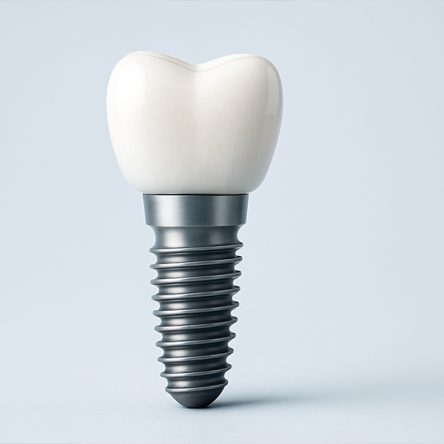 dental implants boca raton, dental implants near you, cosmetic dentist near you